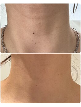 エミニー(Eminy)/プラズマ