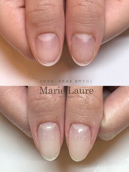 マリーロール 梅田店(Marie Laure)/深爪改善/自爪育成/ネイルケア