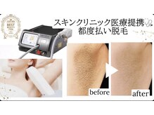 サロンドシェリ エステ(Salon de cheri)の雰囲気（都度払い脱毛☆IPL光脱毛 全身脱毛/VIO脱毛/顔脱毛/フォト効果◎）