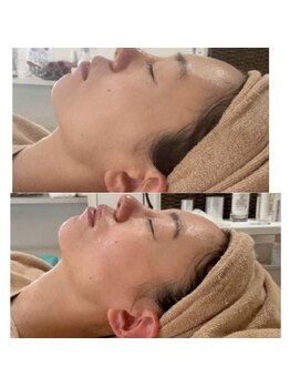 カブール 町田/フェイスラインも変わる!