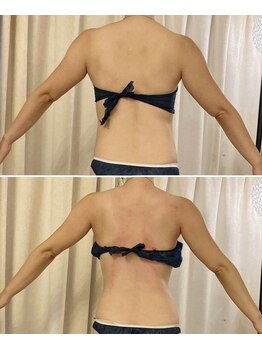 ソエルテ(soerute)/脂肪燃焼漢方