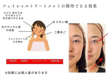 ミニ(MINI)/9DSAMAVI