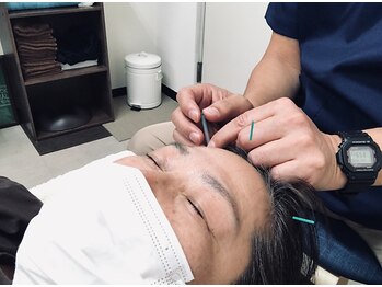 リバー鍼灸院(river鍼灸院)の写真/【鍼灸施術】【土日祝営業】眼精疲労から来るお悩みに終止符を！眼に関連した遠隔の経穴からも施術。