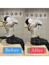 ナオル整体 宮崎院(NAORU整体)/20代女性施術事例【猫背改善】