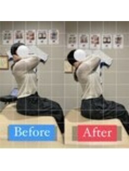 ナオル整体 宮崎院(NAORU整体)/20代女性施術事例【猫背改善】