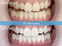 ホワイトニングカフェ 練馬店(WhiteningCafe)