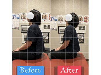 ナオル整体 宮崎院(NAORU整体)/40代女性施術事例【肩こり改善】