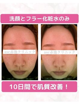 エーエスシー バイ アカイケクリニック イオンモール徳島店(asc by AKAIKE Clinic)/