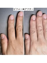 桃の木 吉祥寺店/毎日の習慣で血色美人の爪に♪