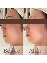 凪眠/小顔リンパフェイシャルの効果41