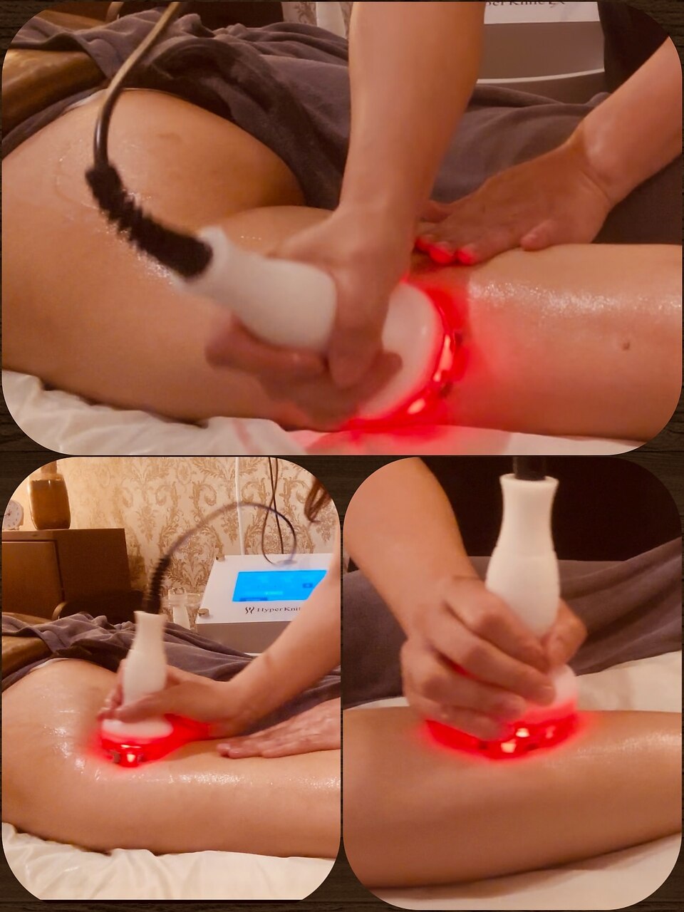 希少機種！速効性No.1新型ハイバーナイフEX2部位+全身経絡リンバ60分\8800