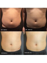 ビトタン 倉敷本店(+美to鍛)/レモンボトル