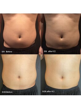 ビトタン 倉敷本店(+美to鍛)/レモンボトル