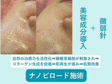 ハッテンビューティーパーク 神戸店(Hatten Beauty Park 810)