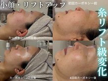 ハニエル(Haniel)の雰囲気（小顔・リフトアップしたい方必見☆驚愕レベルの結果をお届け♪♪）