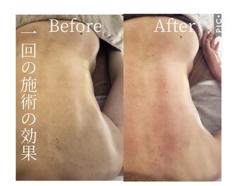 ラムール(L'amour)/リンパマッサージでサイズダウン