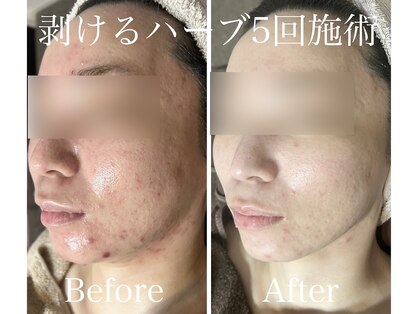 アブニールブリヨンの写真