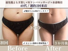 ヨサパークアステラ 神宮前店(YOSAPARK Astella)の雰囲気(深部リンパマッサージで全身のリンパの流れを促進!!)