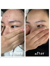 オリンピア 横浜(OLYMPIA)/