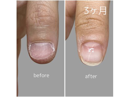 ネイルサロンリシェ 烏丸御池(Recher)の写真