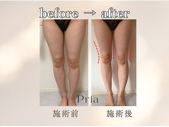 プリア 今治店(Pria)の写真/【頑固な脂肪を撃退！】サイズダウンしたい方におススメ！理想のボディに♪