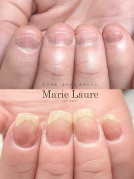 マリーロール 淀屋橋本店(Marie Laure)/自爪育成/深爪矯正/ネイルケア