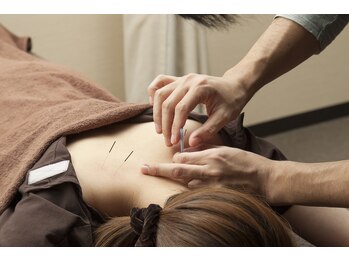 あいいろ鍼灸整体サロン/5　鍼灸