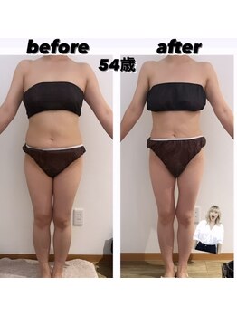 サロン ド モナ(salon de mona)/【正面ビフォーアフター】痩身