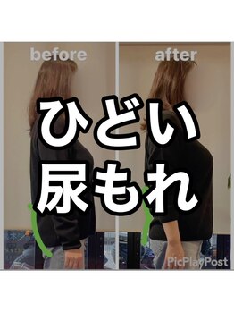 カワル整体 上通り院/尿もれで悩む人