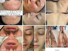 リウル(Reuru)の雰囲気（肌質改善・脱毛の多数症例実績♪）