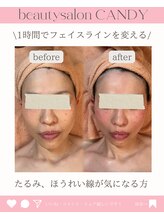 ビューティーサロン キャンディ 海老名(Candy)/
