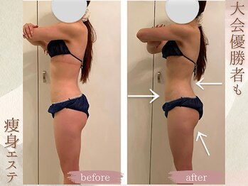 ラナ(LaNa)/レディース大会前のカット出し!