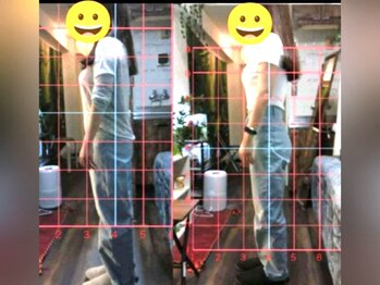 整体院 てんとてん 吉祥寺/姿勢矯正