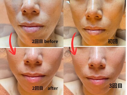 ムー ブランチ(Mou Branch)の写真