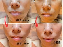 ムー ブランチ(Mou Branch)