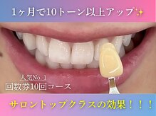 ホワイト 奈良桜井店(WHITE)の雰囲気（歯医者級のホワイトニング効果！お得に通えるクーポンあり♪）