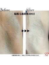 オリオンドットエスツー(Orion.S2)/【Before→After】