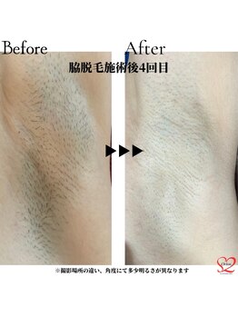 オリオンドットエスツー(Orion.S2)/【Before→After】