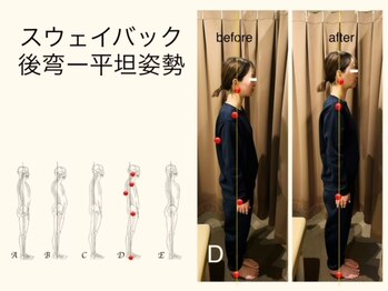 アイリー(Irie)/姿勢分析