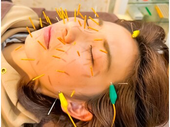 トータルボディサポート ハジメ/鍼灸施術+脱毛