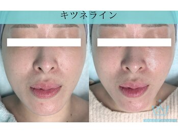 リメイククリニカルビューティー(Remake clinical beauty)/たるみ・もたつき改善