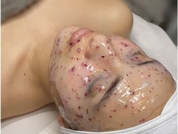 ブランドワンセルフ(BRAND ONE SELF)の写真/ハイクオリティな施術かつ続けられる料金がこだわり★安心の都度払いで美白ケア!低価格&高技術でリピート◎