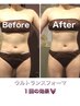 <人気NO1脂肪分解&燃焼＋コリ改善>ウルトラ筋膜全身痩身！初回半額→¥16,500