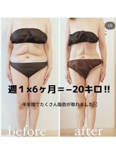 メルローズ 自由が丘店(Melrose)/【お客様の効果写真】