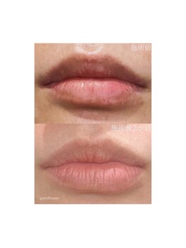 ビーユー(BeYOU.)/【ローマピンク】リップケア☆