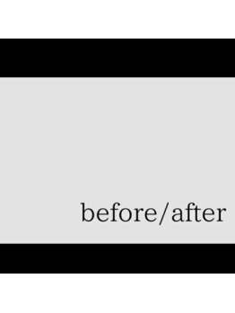 カイロプラクティック よつは/《before after》/beforeafter