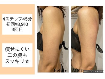 ハピネス(HAPPINESS)/4ステップメニュー　二の腕3回目