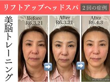 アナパ・オラ/美脳トレーニング【2回/1ヶ月】