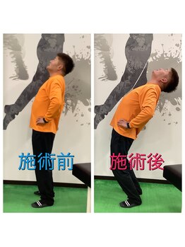 ビーストレッチ イオンモール鈴鹿店(Bee Stretch)/お客様の変化(腰痛)