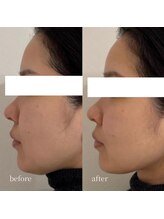 アーネスト 大阪心斎橋店(EARNEST)/韓国式光美容【 リフトアップ 】